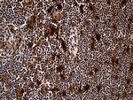 RAD21 Antibody in Immunohistochemistry (Paraffin) (IHC (P))