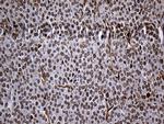 RAD21 Antibody in Immunohistochemistry (Paraffin) (IHC (P))