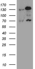 RAD21 Antibody in Western Blot (WB)