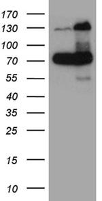 RAD21 Antibody in Western Blot (WB)