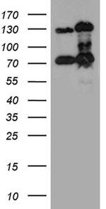 RAD21 Antibody in Western Blot (WB)