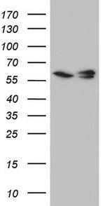 RAD23B Antibody in Western Blot (WB)