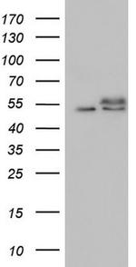 RAD23B Antibody in Western Blot (WB)