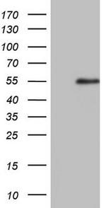 RAD23B Antibody in Western Blot (WB)