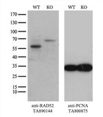 RAD52 Antibody in Western Blot (WB)