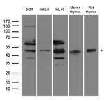 RAD52 Antibody in Western Blot (WB)