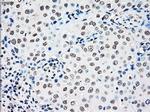 RAD9A Antibody in Immunohistochemistry (Paraffin) (IHC (P))