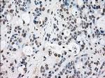 RAD9A Antibody in Immunohistochemistry (Paraffin) (IHC (P))