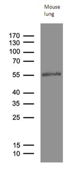 RAGE Antibody in Western Blot (WB)