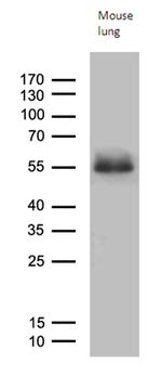 RAGE Antibody in Western Blot (WB)