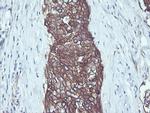 RALB Antibody in Immunohistochemistry (Paraffin) (IHC (P))