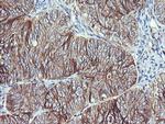 RALB Antibody in Immunohistochemistry (Paraffin) (IHC (P))