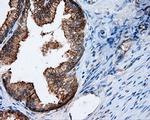 RALBP1 Antibody in Immunohistochemistry (Paraffin) (IHC (P))