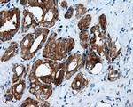 RALBP1 Antibody in Immunohistochemistry (Paraffin) (IHC (P))