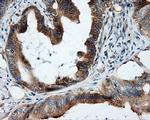 RALBP1 Antibody in Immunohistochemistry (Paraffin) (IHC (P))