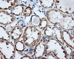 RALBP1 Antibody in Immunohistochemistry (Paraffin) (IHC (P))