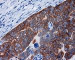 RALBP1 Antibody in Immunohistochemistry (Paraffin) (IHC (P))