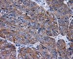 RALBP1 Antibody in Immunohistochemistry (Paraffin) (IHC (P))