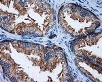 RALBP1 Antibody in Immunohistochemistry (Paraffin) (IHC (P))