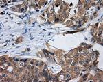 RALBP1 Antibody in Immunohistochemistry (Paraffin) (IHC (P))