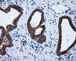 RALBP1 Antibody in Immunohistochemistry (Paraffin) (IHC (P))