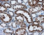 RALBP1 Antibody in Immunohistochemistry (Paraffin) (IHC (P))