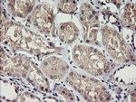 RAMP2 Antibody in Immunohistochemistry (Paraffin) (IHC (P))