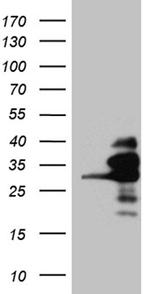 RANBP1 Antibody in Western Blot (WB)