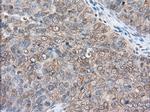 RANGAP1 Antibody in Immunohistochemistry (Paraffin) (IHC (P))