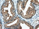 RANGAP1 Antibody in Immunohistochemistry (Paraffin) (IHC (P))