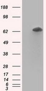 RANGAP1 Antibody in Western Blot (WB)