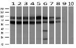 RANGAP1 Antibody in Western Blot (WB)