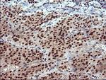 RAPGEF1 Antibody in Immunohistochemistry (Paraffin) (IHC (P))