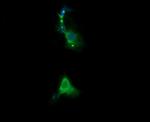 RARRES1 Antibody in Immunocytochemistry (ICC/IF)