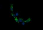 RARRES1 Antibody in Immunocytochemistry (ICC/IF)