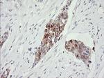 RARRES1 Antibody in Immunohistochemistry (Paraffin) (IHC (P))