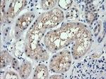 RARRES1 Antibody in Immunohistochemistry (Paraffin) (IHC (P))