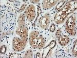 RARRES1 Antibody in Immunohistochemistry (Paraffin) (IHC (P))