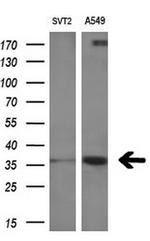 RARRES1 Antibody in Western Blot (WB)