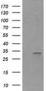 RARRES1 Antibody in Western Blot (WB)