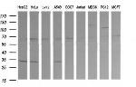 RARRES1 Antibody in Western Blot (WB)