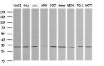 RARRES1 Antibody in Western Blot (WB)