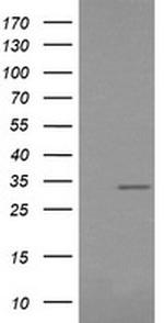 RARRES1 Antibody in Western Blot (WB)