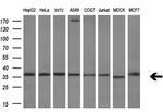 RARRES1 Antibody in Western Blot (WB)