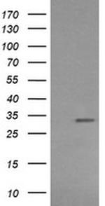 RARRES1 Antibody in Western Blot (WB)