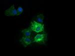 RARRES1 Antibody in Western Blot (WB)