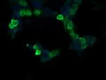 RASA1 Antibody in Immunocytochemistry (ICC/IF)