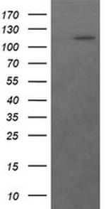 RASA1 Antibody in Western Blot (WB)