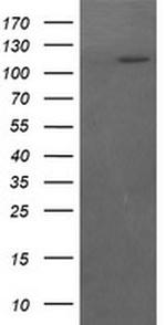 RASA1 Antibody in Western Blot (WB)