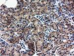 RASD2 Antibody in Immunohistochemistry (Paraffin) (IHC (P))